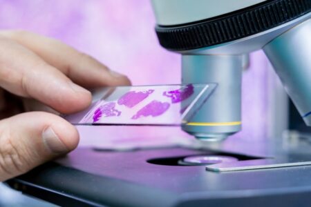 Ocena wyników cytologii według skali Papanicolau i systemu Bethesda